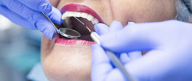 Best Emergency Root Canal Treatment in Searingtown, NY